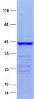 Human NOBOX Protein (Recombinant His, N-Terminal)