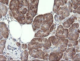 METAP2 Antibody (clone OTI1F6)