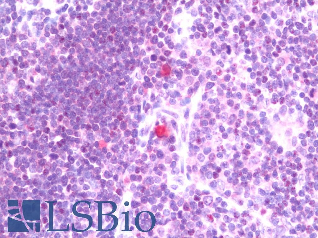 IHC-plus™ PRKCQ / PKC-Theta Antibody (aa504-553)