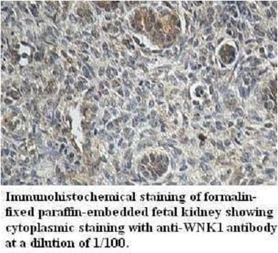 WNK1 Antibody (aa80-338)