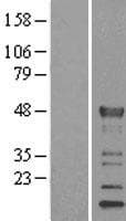 KLF15 Protein (Over-Expression Lysate Myc-DDK (Flag))