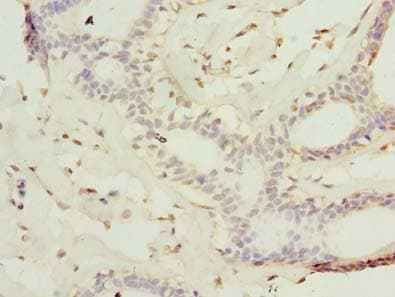 KATNAL2 Antibody