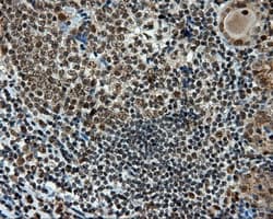 TUBA8 / Tubulin Alpha 8 Antibody (clone OTI2E9)