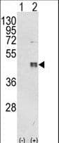 C/EBP Beta / CEBPB Antibody (aa271-298)