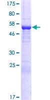 Human NMRAL1 / HSCARG Protein (Recombinant GST)