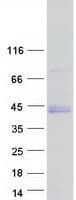 Human BARHL1 Protein (Recombinant Myc-DDK (Flag))