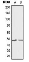 GATA4 Antibody (Internal)