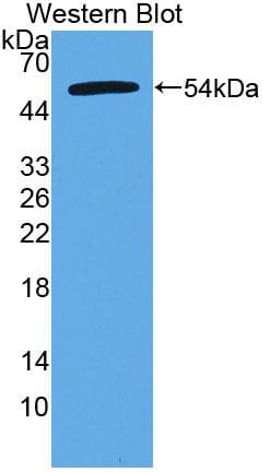 CTRB2 / Chymotrypsinogen B2 Antibody (aa34-263, PE)