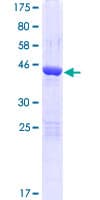 Human ARMC7 Protein (Recombinant GST)