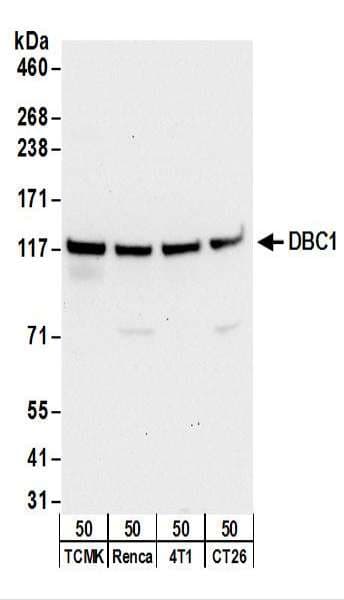 IHC-plus™ CCAR2 / KIAA1967 Antibody (aa875-C-term)