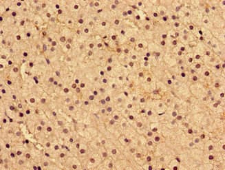 ARA9 / AIP Antibody