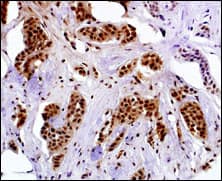 MAGEA4 Antibody (aa9-38)