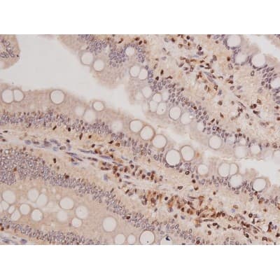 Polyclonal Rabbit anti-Human c-Kit / CD117 Antibody (IHC, IF, WB)
