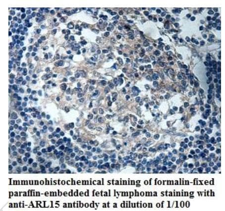 ARL15 Antibody (aa2-204)