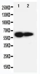 Polyclonal Rabbit anti-Human IL2RB / CD122 Antibody (aa117-135, WB)