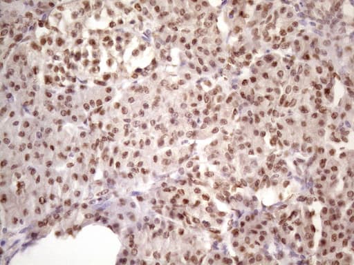 IKBKE / IKKI / IKKE Antibody (aa474-716, clone OTI3C5, Carrier-free)