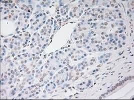 VEGFA / VEGF Antibody (clone OTI4E3)