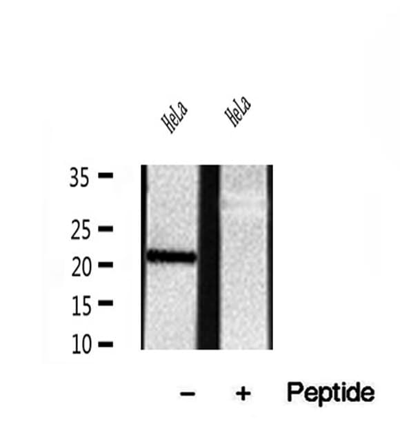 Polyclonal Rabbit anti-Human REEP5 Antibody (IHC, WB)