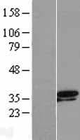 TSEN34 Protein (Over-Expression Lysate Myc-DDK (Flag))