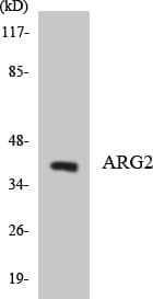 IHC-plus™ ARG2 / Arginase 2 Antibody (aa305-354)