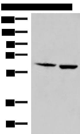 Polyclonal Rabbit anti-Human JRKL Antibody (WB)