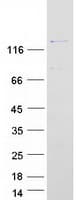 Human PPP1R12A / MYPT1 Protein (Recombinant Myc-DDK (Flag))