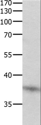 DUSP12 Antibody