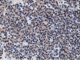 Dipeptidyl Peptidase 3 / DPP3 Antibody (clone OTI2D9)