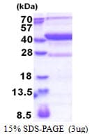 Human MAP1D Protein (Recombinant His)