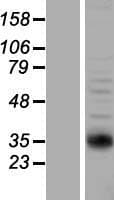 NAT2 Protein (Over-Expression Lysate Myc-DDK (Flag))