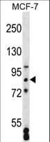 SATB2 Antibody (aa410-439)