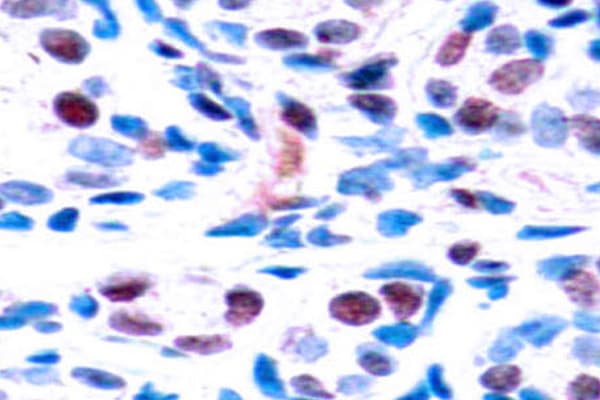 Polyclonal Rabbit anti-Human STAT3 Antibody (phospho-Tyr705, IHC, WB)