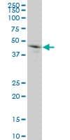 GRN / Granulin Antibody (clone 1F5)