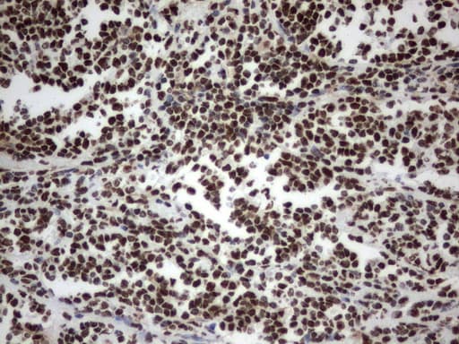 MLF1 Antibody (clone UMAB138)