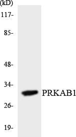 PRKAB1 / AMPK Beta 1 Antibody (aa17-66)