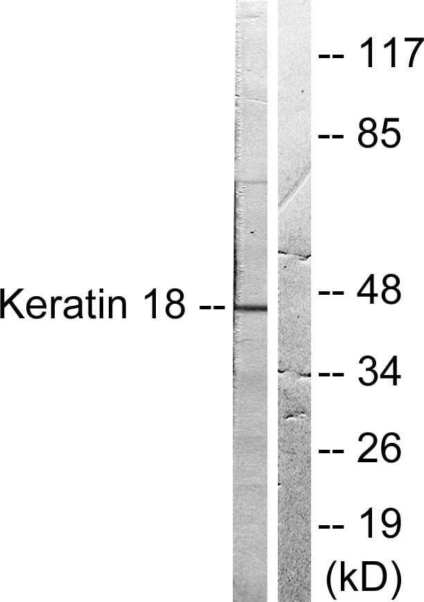 KRT18 / CK18 / Cytokeratin 18 Antibody (aa1-50)