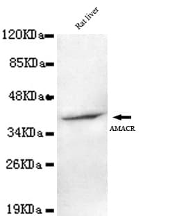 AMACR / P504S Antibody (C-Terminus)
