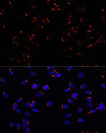 Polyclonal Rabbit anti-Human GOLGA5 Antibody (IF)
