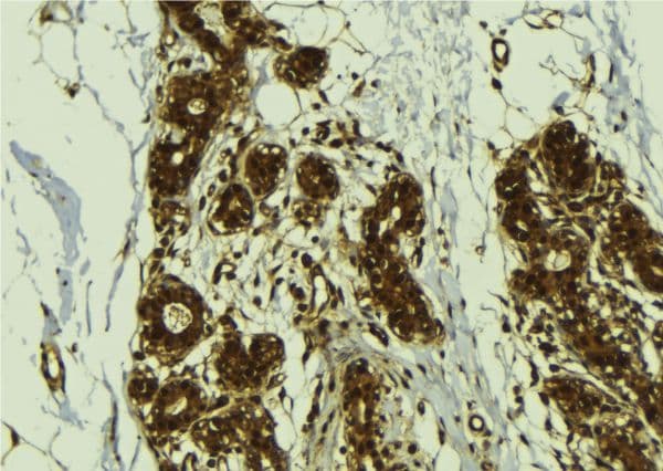 CGGBP1 Antibody