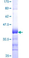 Human CPNE7 Protein (Recombinant GST, N-terminus)