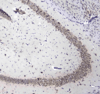 L1CAM Antibody