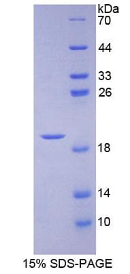 Mouse APOA1BP Protein (Recombinant His-S)