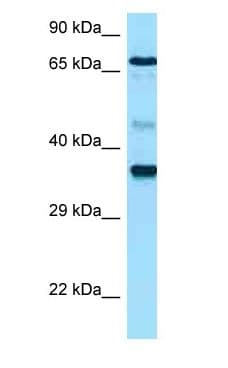 Polyclonal Rabbit anti-Human HAS1 / HAS Antibody (aa171-220, WB)