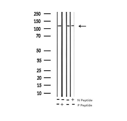 HDAC5 Antibody (phospho-Ser498)