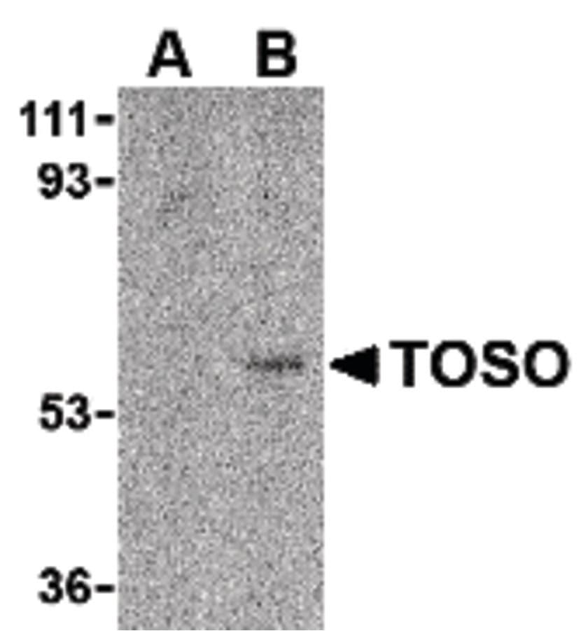 IHC-plus™ FCMR / FAIM3 Antibody