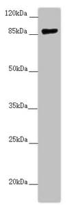 Polyclonal Rabbit anti-Human CCHCR1 Antibody (IHC, WB)