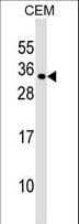 MXD1 / MAD1 Antibody (aa23-50)