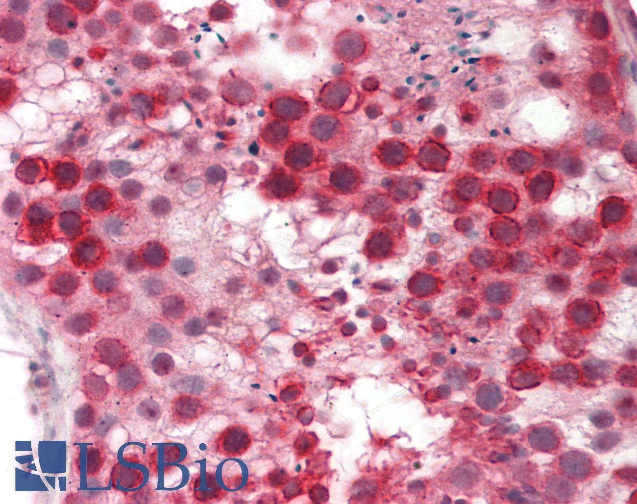 MMS21 / NSMCE2 Antibody (aa107-156)