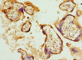 Polyclonal Rabbit anti-Human BNIP2 Antibody (IHC)