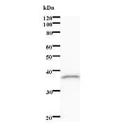 ALX1 Antibody (clone 3329D3a)